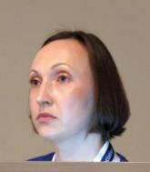 Old standby valproic acid appears effective against hyperactive delirium